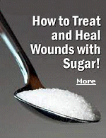 For thousands of years, surgeons used sugar for healing wounds. During the Napoleonic wars, soldiers packed gunshot-wounds with it, helping to keep the wound dry, and promoting new tissue to grow. Be sure to add granulated sugar to your emergency survival kit.